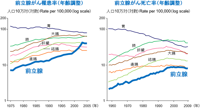 日本における前立腺がんの罹患率と死亡率